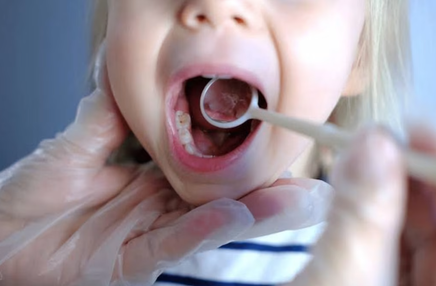 Beyond Cavities: What Your Child's Mouth Can Reveal About Their Wider Wellbeing