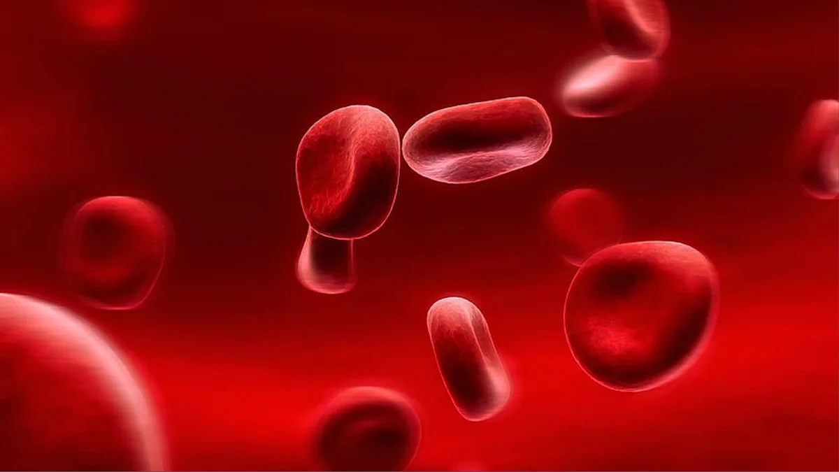 Anemia: Unravelling the Threads of a Common Blood Disorder