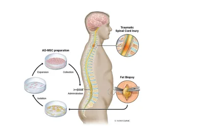 Stem Cell MedEdge