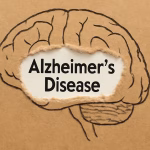 Alzheimer's Research