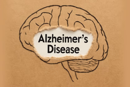 Alzheimer's Research