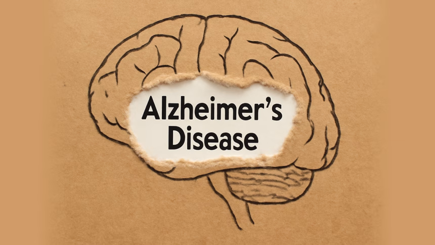 Alzheimer's Research