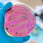 Antimicrobial resistance (AMR)
