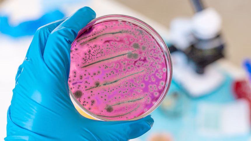 Antimicrobial resistance (AMR)