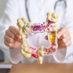 Bowel Cancer.jpg
