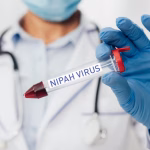 Nipah Virus