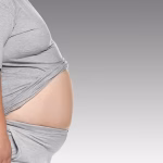obesity