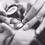 Algeria eliminates trachoma.jpg