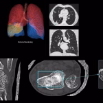 GE HealthCare broadens its deep learning.jpg