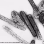 Marburg virus disease.jpg